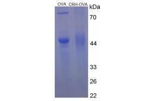Image no. 1 for Corticotropin Releasing Hormone (CRH) peptide (Ovalbumin) (ABIN5666140)