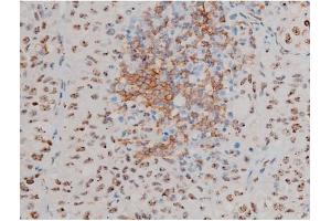 Image no. 9 for anti-Jun D Proto-Oncogene (JUND) (pSer255) antibody (ABIN6255135)