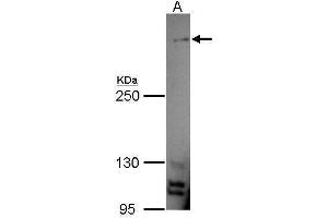 Image no. 2 for anti-Mucin 4, Cell Surface Associated (MUC4) (Center) antibody (ABIN2854862)