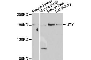 Image no. 1 for anti-Ubiquitously Transcribed Tetratricopeptide Repeat Gene, Y-Linked (UTY) antibody (ABIN6571841)