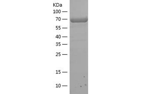 NFKB1 Protein (AA 1-368) (His-IF2DI Tag)