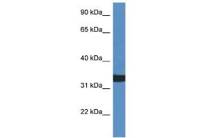 Image no. 1 for anti-Alkaline Ceramidase 1 (ACER1) (C-Term) antibody (ABIN2788591)