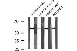 Image no. 4 for anti-Dihydrouridine Synthase 2-Like (DUS2L) antibody (ABIN6261379)