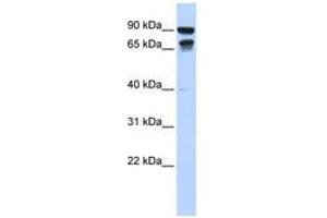 Image no. 1 for anti-Male-Specific Lethal 3 Homolog (MSL3) (N-Term) antibody (ABIN6740626)