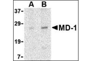 Western blot analysis of MD-1 in Daudi cell lysate with this product at (A) 1 and (B) 2 μg/ml.