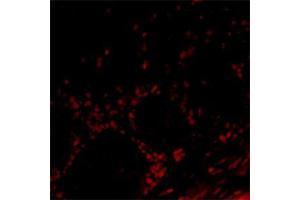 Image no. 2 for anti-Olfactory Marker Protein (OMP) antibody (ABIN350659)