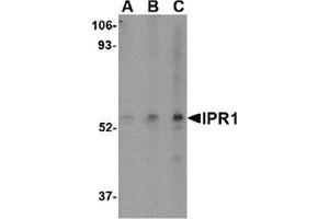 Image no. 2 for anti-SP110 Nuclear Body Protein (SP110) (C-Term) antibody (ABIN783558)