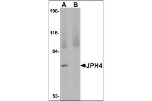 Image no. 2 for anti-Junctophilin 4 (JPH4) (C-Term) antibody (ABIN500104)