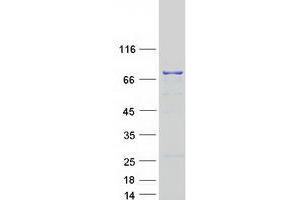 Image no. 1 for DEXH (Asp-Glu-X-His) Box Polypeptide 58 (DHX58) protein (Myc-DYKDDDDK Tag) (ABIN2719466)