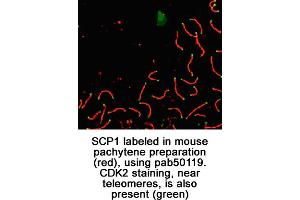 Image no. 1 for anti-Synaptonemal Complex Protein 1 (SYCP1) (C-Term) antibody (ABIN363428)