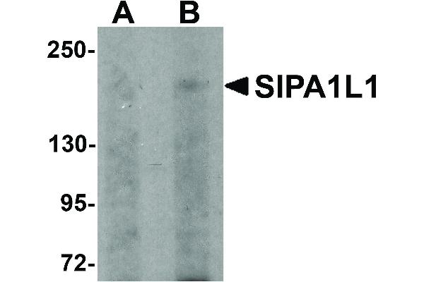anti-Signal-Induced Proliferation-Associated 1 Like 1 (SIPA1L1) (N-Term) antibody
