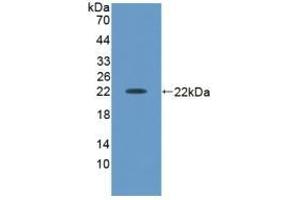 ACVA Antikörper  (AA 44-178)