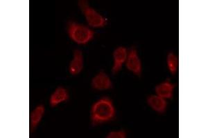Image no. 1 for anti-Zona Pellucida Glycoprotein 1 (ZP1) antibody (ABIN6258426)