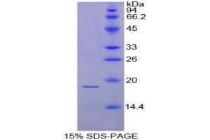 Image no. 1 for Thyroid Stimulating Hormone, beta (TSHB) protein (ABIN1080929)