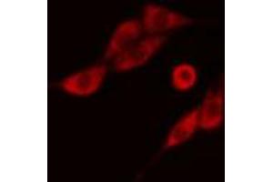 Image no. 1 for anti-Nuclear Cap Binding Protein Subunit 2 (NCBP2) antibody (ABIN6257882)