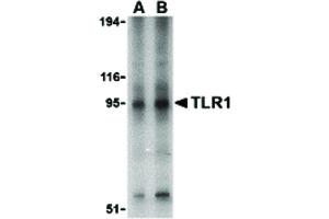 Image no. 1 for anti-Toll-Like Receptor 1 (TLR1) (Internal Region) antibody (ABIN6655391)