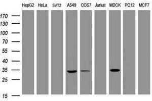 Image no. 10 for anti-Mucin 1 (MUC1) antibody (ABIN1499598)