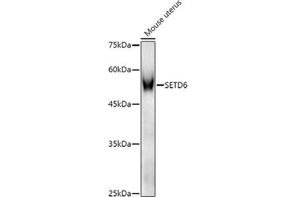 SETD6 抗体  (AA 301-473)
