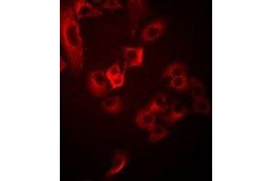 Image no. 1 for anti-Nitrogen Permease Regulator-Like 2 (S. Cerevisiae) (NPRL2) antibody (ABIN3198359)