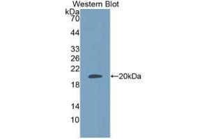 Western Blotting (WB) image for Adrenomedullin (ADM) ELISA Kit (ABIN6574074)