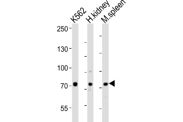 SDAD1 antibody  (C-Term)