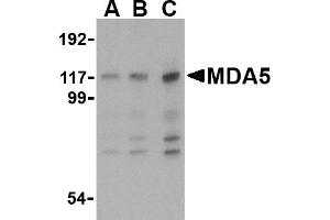 Image no. 2 for anti-Interferon Induced with Helicase C Domain 1 (IFIH1) (Middle Region) antibody (ABIN1031000)