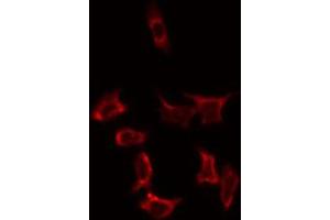 Image no. 1 for anti-Solute Carrier Family 25 (Mitochondrial Carrier, Adenine Nucleotide Translocator), Member 31 (SLC25A31) antibody (ABIN6258664)