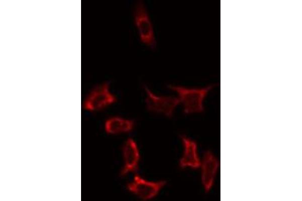 anti-Solute Carrier Family 25 (Mitochondrial Carrier, Adenine Nucleotide Translocator), Member 31 (SLC25A31) (Internal Region) antibody