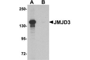 Image no. 2 for anti-Lysine (K)-Specific Demethylase 6B (Kdm6b) (N-Term) antibody (ABIN1450111)