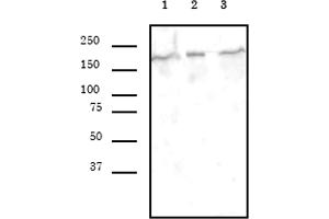 Image no. 1 for anti-SWI/SNF Related, Matrix Associated, Actin Dependent Regulator of Chromatin, Subfamily A, Member 4 (SMARCA4) (AA 213-295) antibody (ABIN6972735)