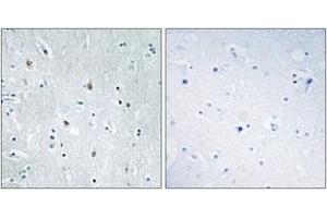 Image no. 1 for anti-SRY (Sex Determining Region Y)-Box 12 (SOX12) (AA 71-120) antibody (ABIN1533499)