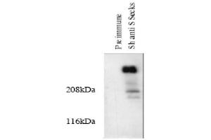 Image no. 1 for anti-A Kinase (PRKA) Anchor Protein 12 (AKAP12) (AA 620-1596) antibody (ABIN264964)
