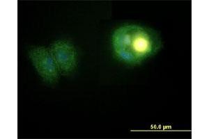 Image no. 2 for anti-Cadherin 2 (CDH2) antibody (ABIN6923069)