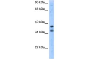 Image no. 1 for anti-Potassium Channel Regulator (KCNRG) antibody (ABIN2461173)