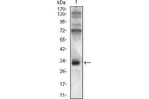 Image no. 4 for anti-HLA-DR-gamma (CD74) (AA 1-106) antibody (ABIN1724871)