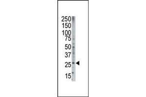Western Blotting (WB) image for anti-BCL2-Related Ovarian Killer (BOK) (BH3 Domain) antibody (ABIN2159579)
