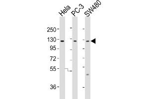 Image no. 2 for anti-Solute Carrier Organic Anion Transporter Family, Member 1B3 (SLCO1B3) (AA 639-668), (C-Term) antibody (ABIN1537518)