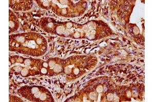 CCDC6 antibody  (AA 347-440)