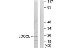Image no. 1 for anti-Leucine Zipper, Down-Regulated in Cancer 1-Like (LDOC1L) (AA 141-190) antibody (ABIN1533958)
