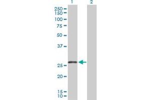 Western Blot analysis of TNFRSF13C expression in transfected 293T cell line by TNFRSF13C MaxPab polyclonal antibody.