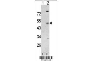 Image no. 2 for anti-Phosphoinositide-3-Kinase, Regulatory Subunit 5 (PIK3R5) (AA 392-421) antibody (ABIN392579)
