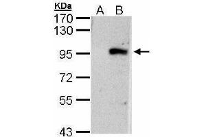WB Image Western Blot analysis of ECEL1 expression in transfected 293T cell line by ECEL1 polyclonal antibody.