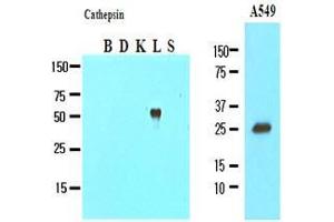 Image no. 1 for anti-Cathepsin L1 (CTSL1) (AA 114-333) antibody (ABIN934040)