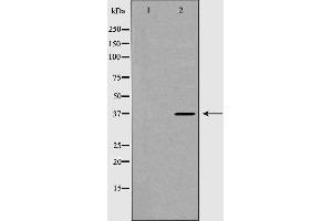 Image no. 1 for anti-DKK3 antibody (ABIN6261307)