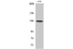 Image no. 1 for anti-Janus Kinase 1 (JAK1) (pTyr1022) antibody (ABIN3182053)