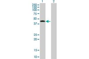 Image no. 2 for anti-Septin 12 (Sep12) (AA 1-358) antibody (ABIN530515)
