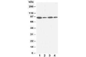 Image no. 2 for anti-Feline Sarcoma Oncogene (FES) (C-Term) antibody (ABIN3030922)