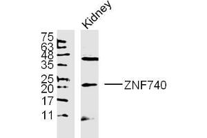 ZNF740 lysates probed with Polyclonal Antibody, unconjugated  at 1:300 overnight at 4°C followed by a conjugated secondary antibody at 1:10000 for 90 minutes at 37°C.