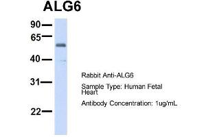 Image no. 4 for anti-Asparagine-Linked Glycosylation 6, alpha-1,3-Glucosyltransferase Homolog (ALG6) (N-Term) antibody (ABIN2782789)