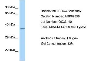 Image no. 1 for anti-Leucine Rich Repeat Containing 39 (LRRC39) (C-Term) antibody (ABIN2789270)